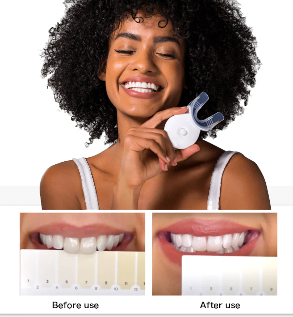Liroxa™ Teeth Whitening Gel Refill 3X