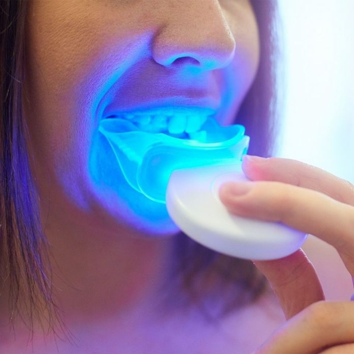 Liroxa™ LED Teeth Whitening Accelerator
